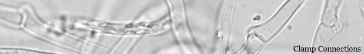 Microscope view of clamp connections. Microscope view of clamp connections.