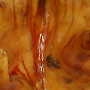 Stereum gausapatum, PRL 10619 Close-up of underside.